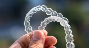 Why Retainers Need to Be Cleaned?